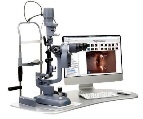 Slit Lamp พร้อมกล้องและจอแสดงภาพดวงตา